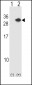 RCAN1 Antibody (N-term)